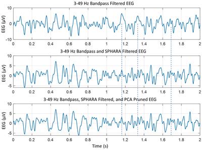 Spatiotemporal phase slip patterns for visual evoked potentials, covert object naming tasks, and insight moments extracted from 256 channel EEG recordings